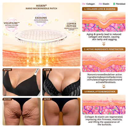 𝐏𝐡𝐲𝐬𝐢𝐜𝐢𝐚𝐧 𝐅𝐨𝐫𝐦𝐮𝐥𝐚𝐭𝐞𝐝🧤|M𝐑𝐄𝐕𝐁𝑺𝑰𝑵® Bust Volume, Lift & Firming Nano Microneedle Patch Astaxanthin + Volufiline + Exosome + Copper Peptide Formula Powered by Cellular Renewal Technology